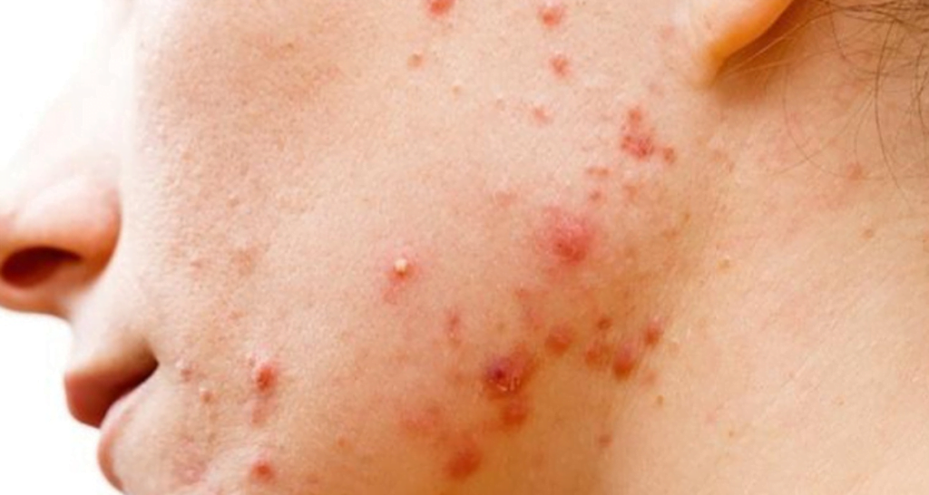 Médecine esthétique - dermatologie interventionnelle Casablanca